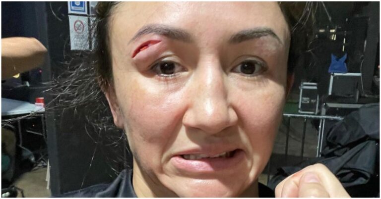 VIDEO | Carla Esparza Cut Following Head Clash At Fury Grappling 3