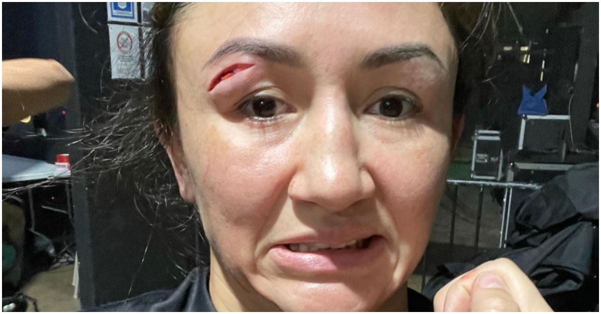 VIDEO | Carla Esparza Cut Following Head Clash At Fury Grappling 3 1 Carla Esparza