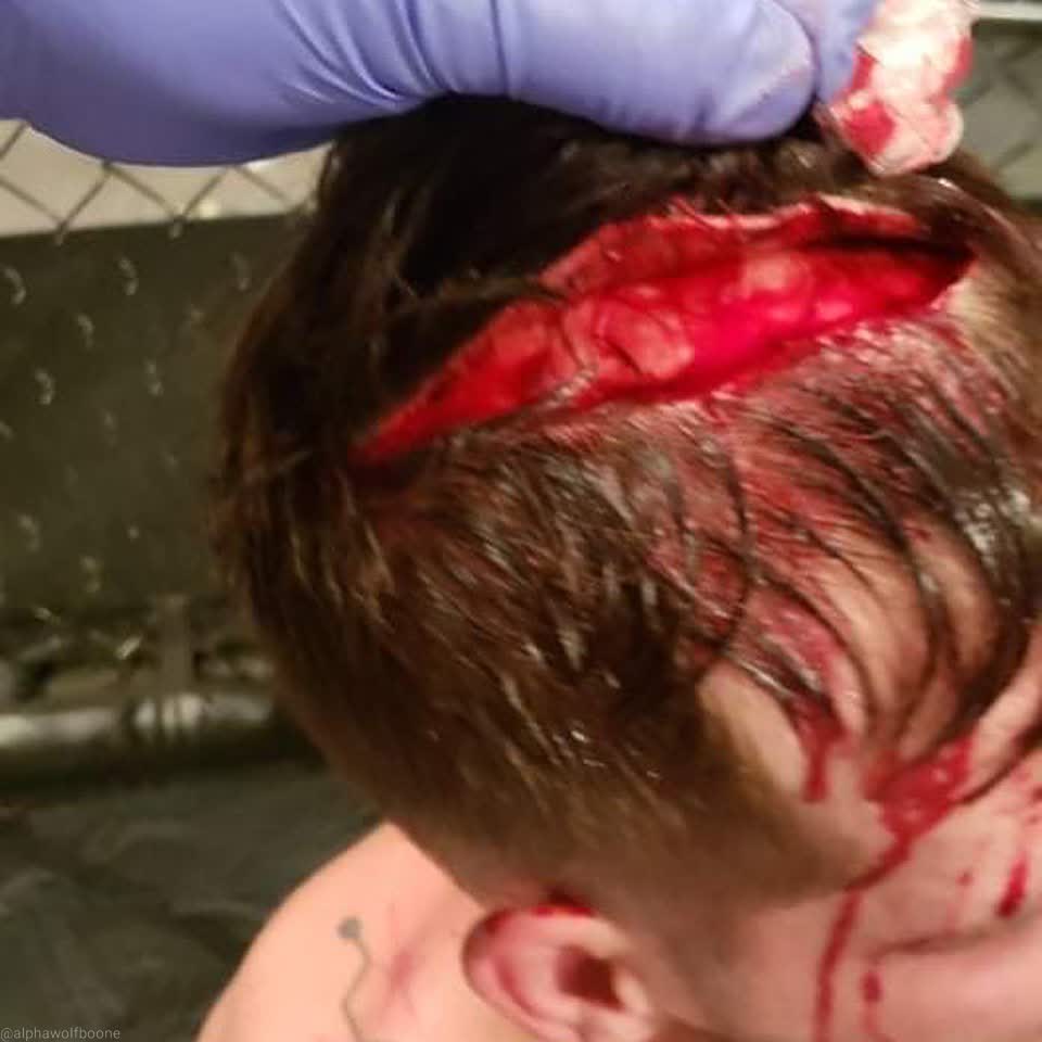 Hunter Boone Severely Hurt By Exposed MMA Cage Piece 2 273868632 1243746899368246 3899516677357342920 n 1 1