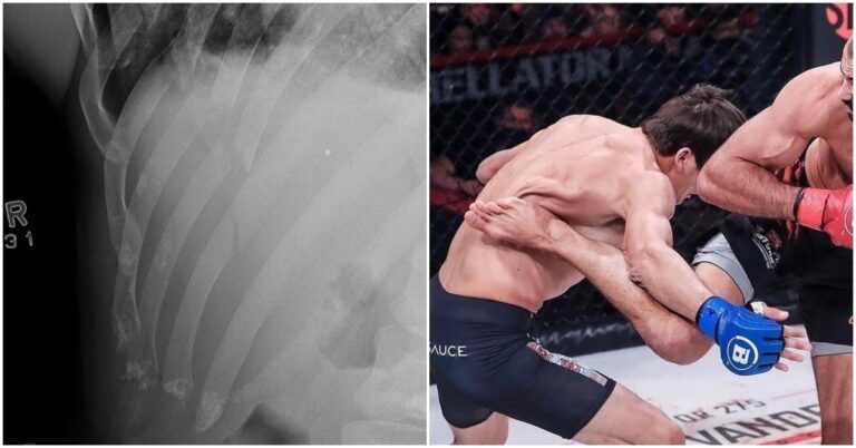 Chance Rencountre Hospitalized After A Kick At Bellator 274