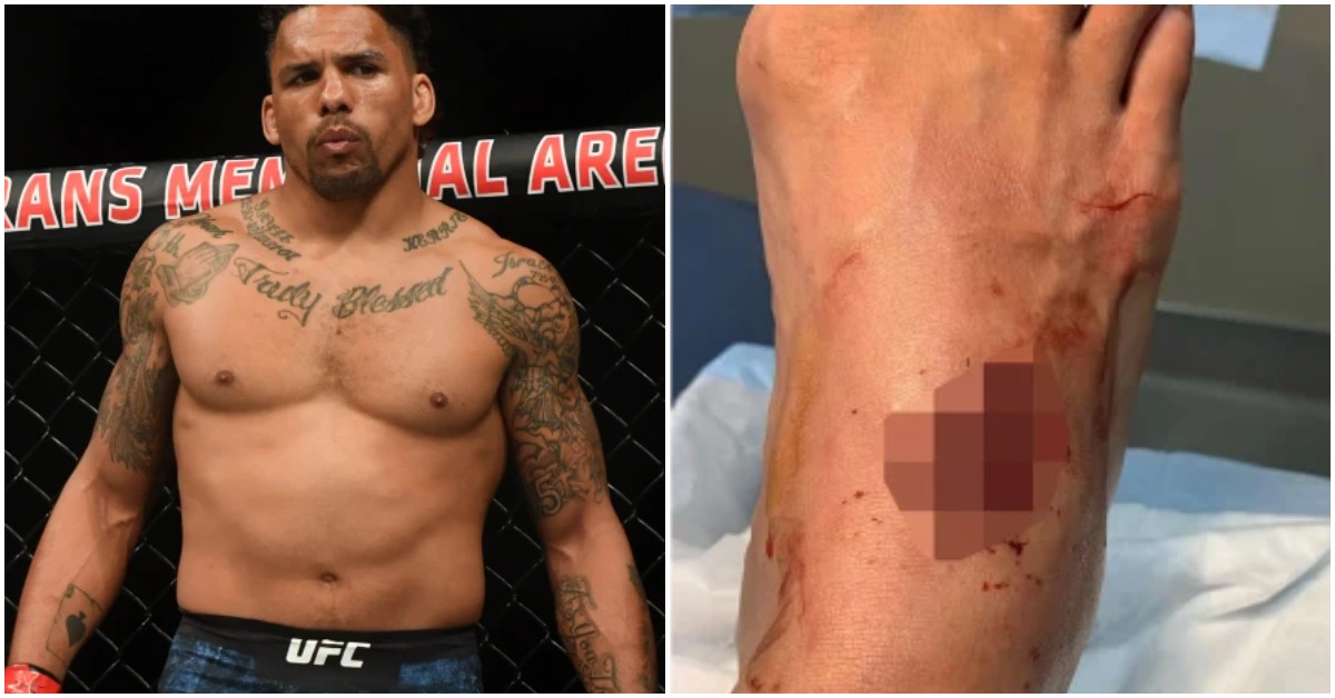 UFC fighter Eryk Anders slices up foot in horrific chainsaw accident 1 Eryk Anders