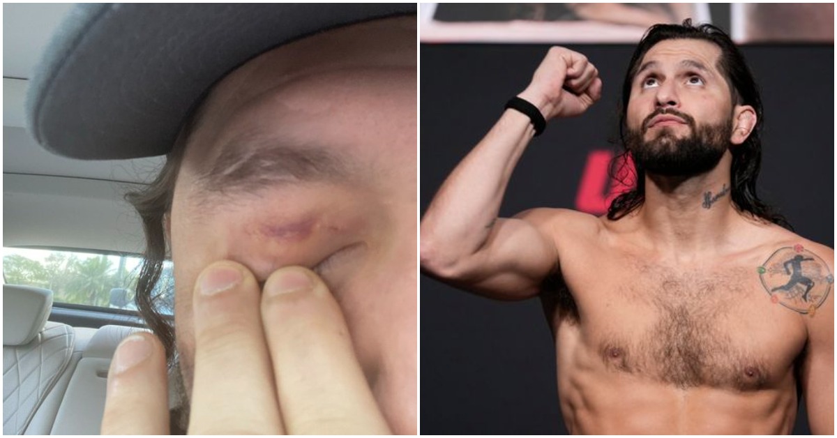Jorge Masvidal Shares Photo Of Eye Injury, Blames 'Cheating F*ck' Colby Covington 1 Jorge Masvidal