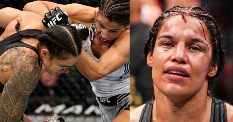 Dana White Reveals Julianna Peña ‘Lost A Big Chunk’ Of Her Forehead In Gutsy Loss To Amanda Nunes At UFC 277