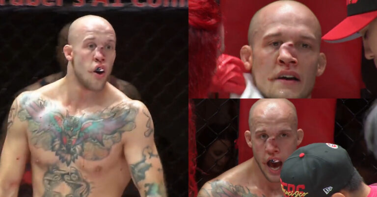 MMA Fighter Disfigured After Getting Brutally Kneed In The Face