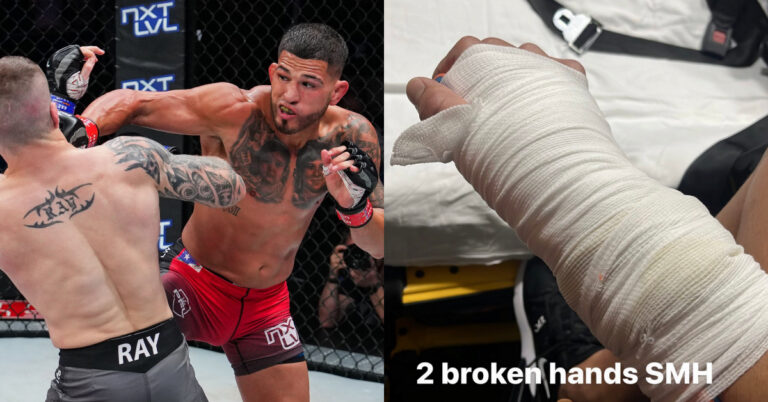 Photo: Anthony Pettis broke both his hands in second defeat to Stevie Ray at PFL Playoffs