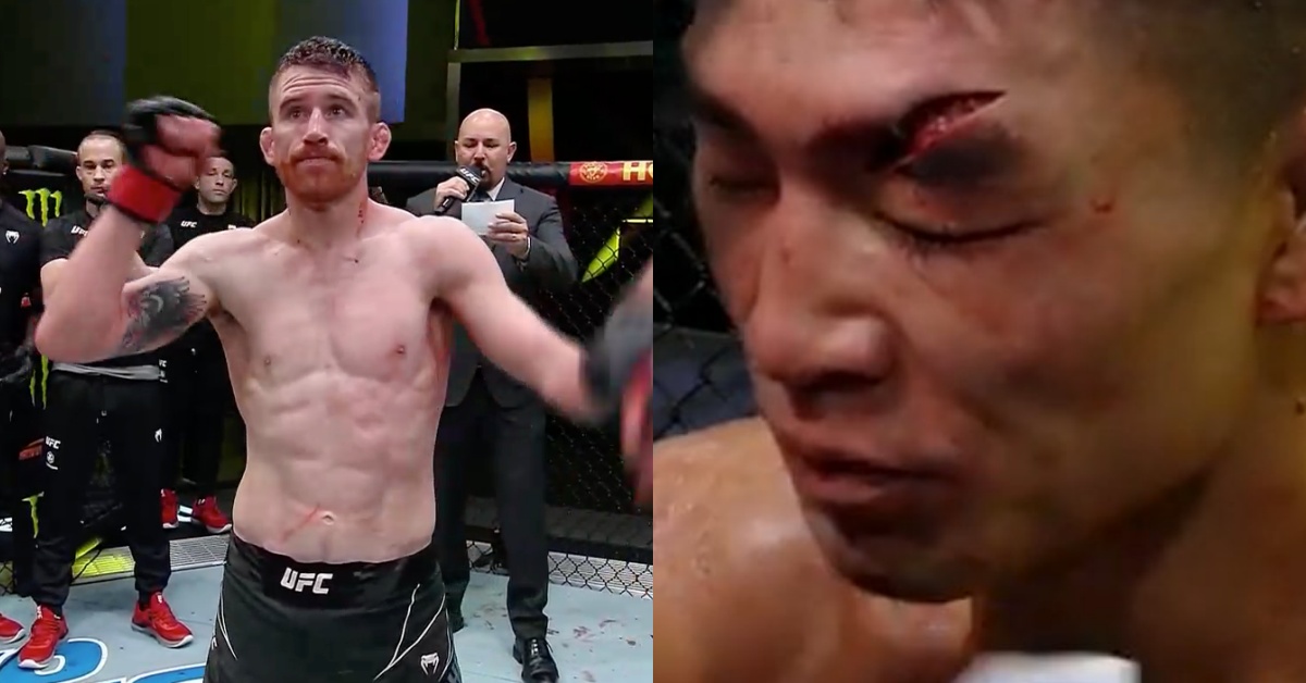Cory Sandhagen slices brutal cut on Song Yadong, forces doctor's stoppage win - UFC Vegas 60 Highlights 1 Cory Sandhagen