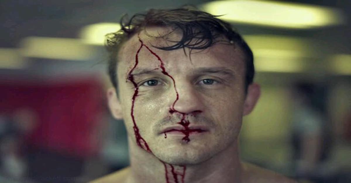 Brad Pickett Bloody