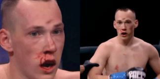 Danil Sharov suffers skull fracture