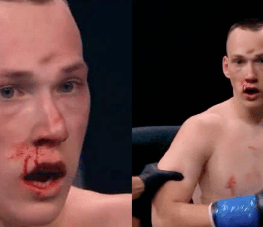 Danil Sharov suffers skull fracture