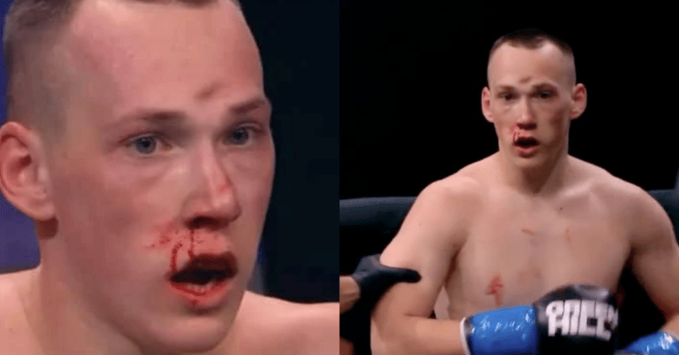 Watch | Danil Sharov suffers skull fracture in kickboxing debut from a knee strike