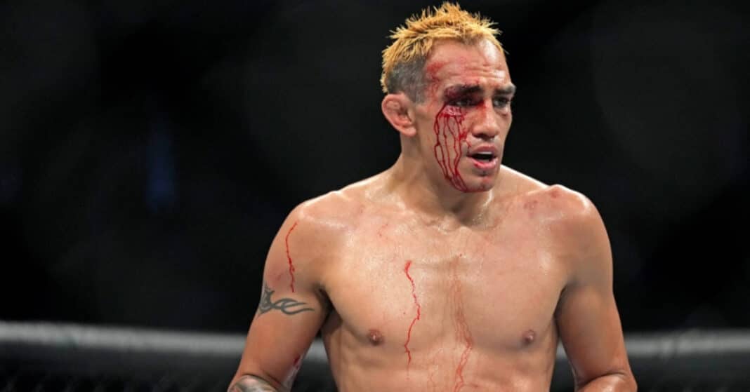 Tony Ferguson