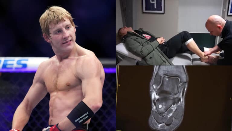 Paddy Pimblett to have ankle surgery in March, UFC London appearance now in question