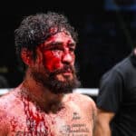Diego Sanchez, Austin Trout, BKFC