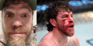 Jim Miller Eye