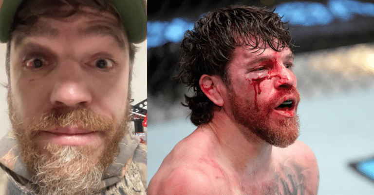 Jim Miller suffered traumatic cataract in Alexander Hernandez bout: “Update on my eyeball. Not the one I wanted to get, but I’ll continue to move forward.”