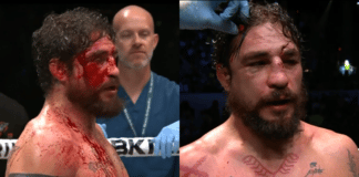 Diego Sanchez BKFC