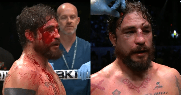 Diego Sanchez bloodied and battered in BKFC debut, suffers fourth round stoppage loss