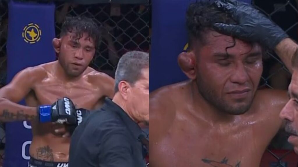 Video José Peñaloza's Exploded Cauliflower Ear Leads To Stoppage At