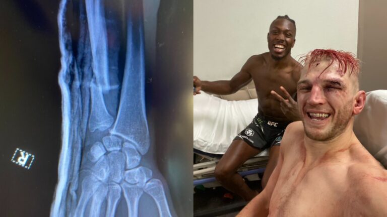 Dan Hooker reveals x-Ray of broken wrist suffered in bloody war with Jalin Turner at UFC 290: ‘Just a scratch’