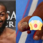 Jon Jones