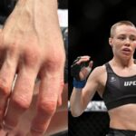 Rose Namajunas hand injury pictures after UFC Paris loss Manon Fiorot