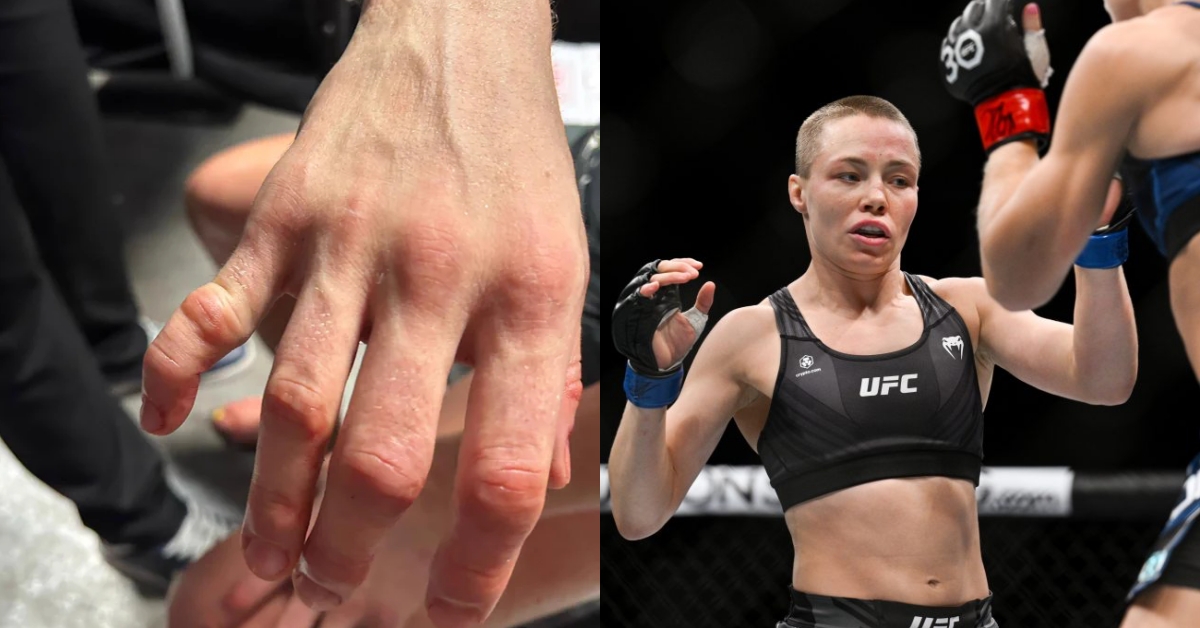 Rose Namajunas hand injury pictures after UFC Paris loss Manon Fiorot