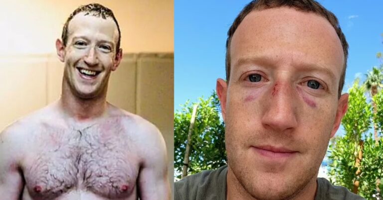 Facebook founder Mark Zuckerberg emerges from latest sparring session sporting two black eyes