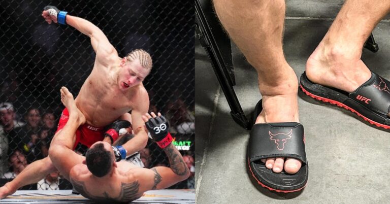 Paddy Pimblett’s foot is a mangled mess following his UFC 296 Victory over Tony Ferguson