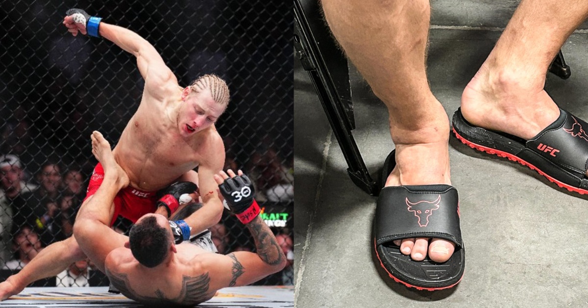 Paddy Pimblett's foot is a mangled mess following his UFC 296 Victory over Tony Ferguson 1 Paddy Pimblett
