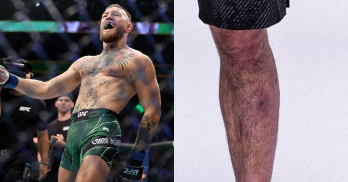 Conor McGregor rips Islam Makhachev amid speculation over infection pre-UFC 302: ‘This inbred lives with staph’