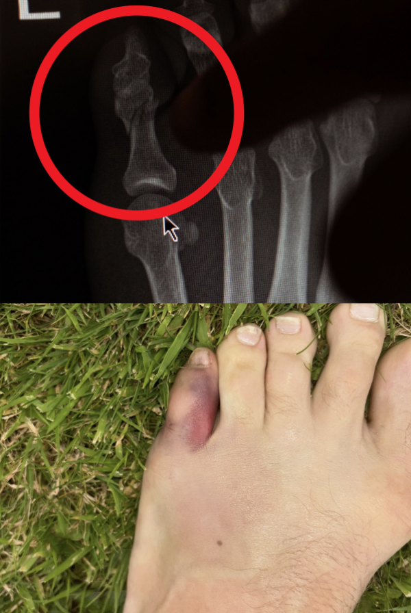 Conor McGregor reveals exact moment he broke his toe, forcing him out of UFC 303 fight with Michael Chandler 2 Conor McGregor toe