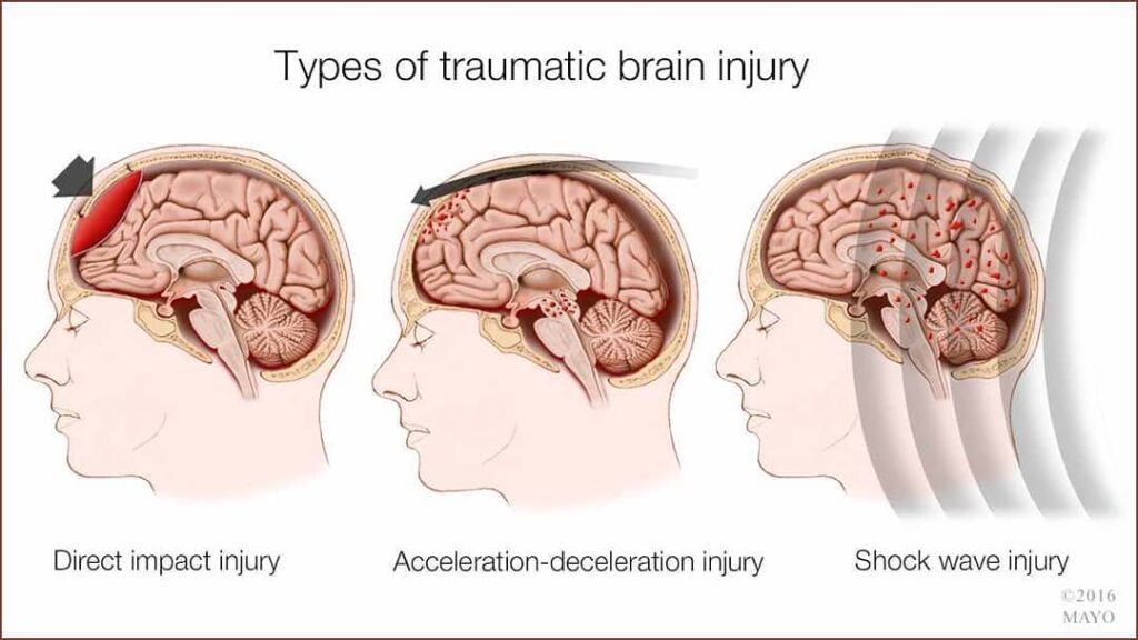 Dana White Reveals Brain Damage with Scans revealing Black Spots: "I wouldn't take one punch back." 2 Dana White on Power Slap