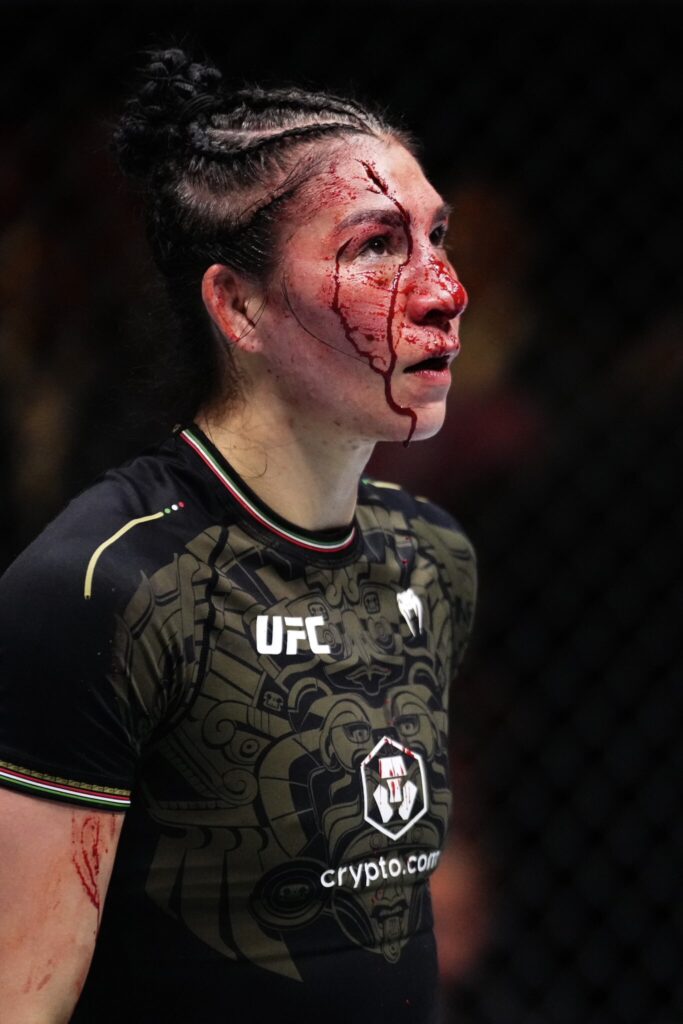 NSFW Gore: Irene Aldana's gruesome forehead cut: One of the worst in MMA history? 4 aldana