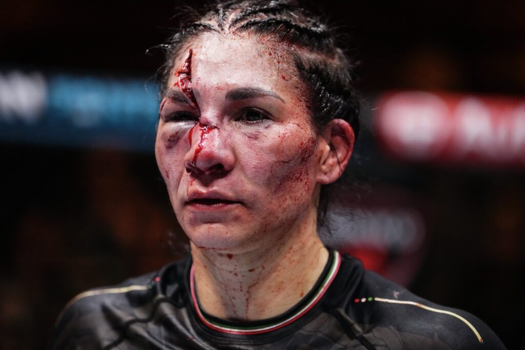 NSFW Gore: Irene Aldana's gruesome forehead cut: One of the worst in MMA history? 3 irene