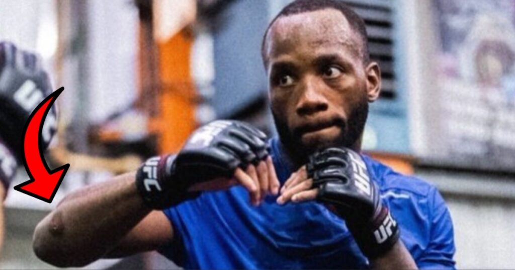 Leon Edwards Addresses Staph Infection Concerns Ahead of UFC London