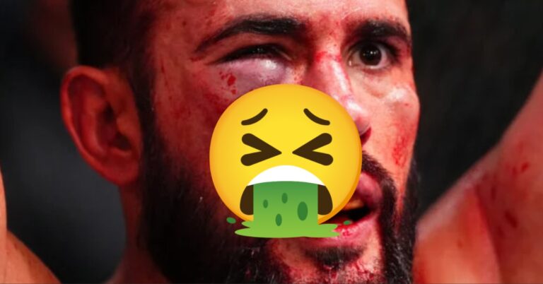 Dana White Shows Off UFC Fighter's Horrifying Lip Injury