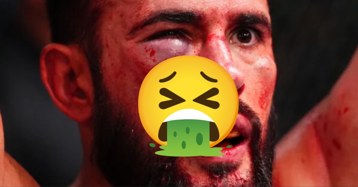 Dana White Reveals UFC Fighter's Horrifying Injury in Extremely Graphic Video 1 Dana White Shows Off UFC Fighter's Horrifying Lip Injury