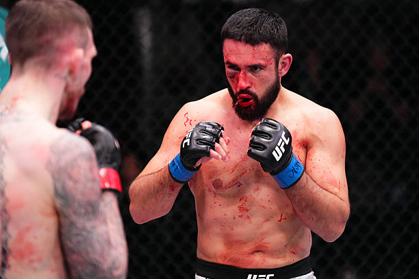 Dana White Reveals UFC Fighter's Horrifying Injury in Extremely Graphic Video 3 gettyimages 2208726714 612x612 1