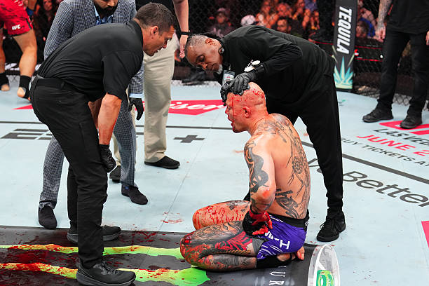 Mingyang Zhang Bloodies 'Lionheart' En Route to Vicious First-Round TKO - UFC Kansas City Highlights 3 gettyimages 2212170176 612x612 1