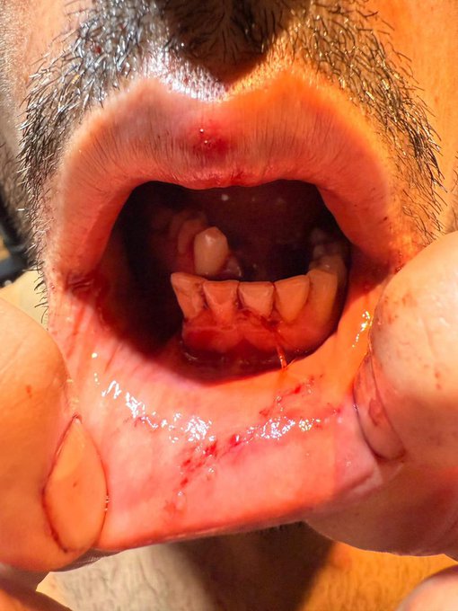 Wahed Nazhand Wins Bonus, But Loses Teeth in Dramatic Comeback at Oktagon 73 5 GunbHvdXIAAMlrB