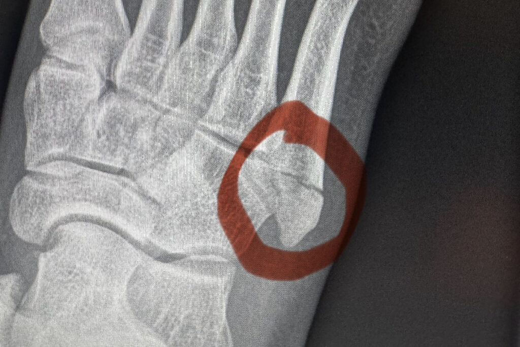 Watch - UFC Star Manel Kape's Grueling Foot Injury Caught on Camera 4 Screenshot 2025 06 09 at 2.56.32 PM.0