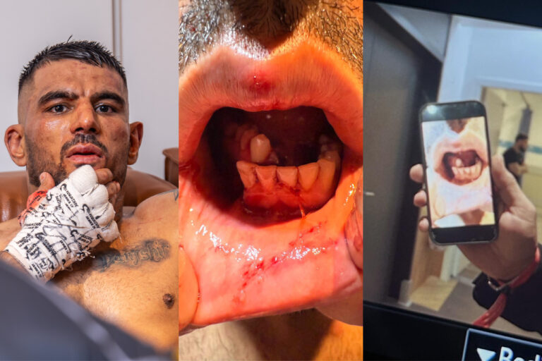 Wahed Nazhand Wins Bonus, But Loses Teeth in Dramatic Comeback at Oktagon 73