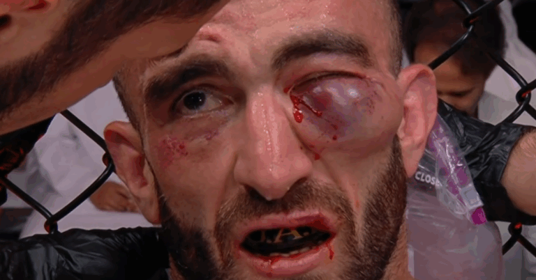Look BRUTAL Severe Swlling of Mohammad Yahya Stuns UFC Fans