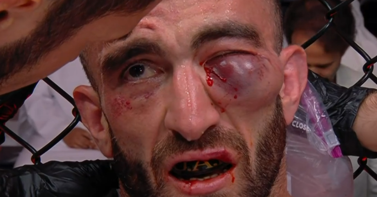 Look: BRUTAL Severe Swelling of Mohammad Yahya Stuns UFC Fans