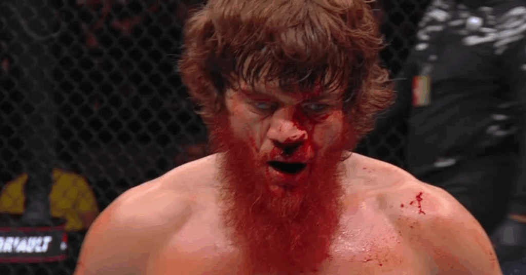 Shara Bullet Hospitalized in Abu Dhabi for Nose Surgery Following UFC Bout
