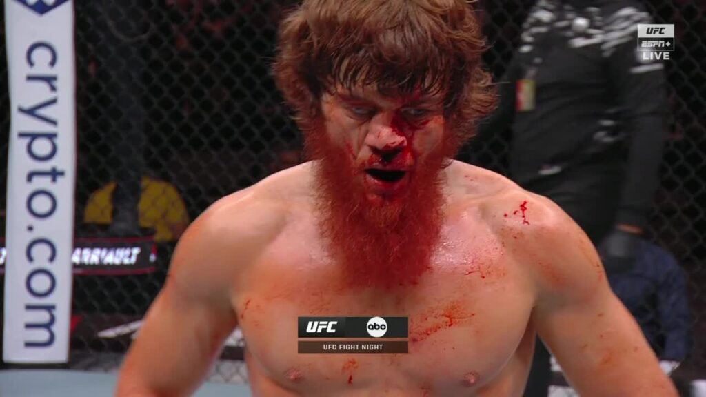 UFC Champion Dricus Du Plessis SLAMS Shara Bullet After Victory with just four words 17 shara