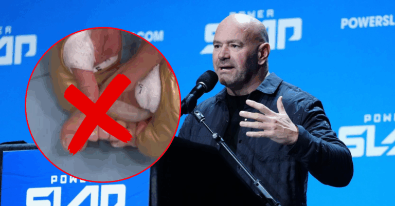 Did Alex Pereira Break His Toe in the UFC 320 Main Event? Dana White Reveals