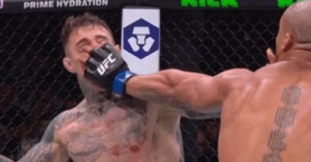 MMA Community Dismisses Chael Sonnen and Anthony Smith's Tom Aspinall Criticism After UFC 321 Eye Poke