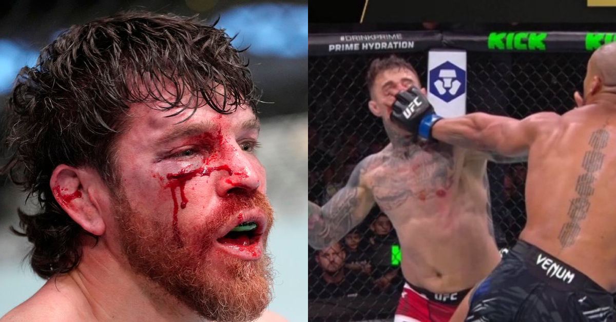 UFC Vet Jim Miller: The Sport Has Done Nothing About Eye Pokes, and It’s Going to Cost Someone Their Vision