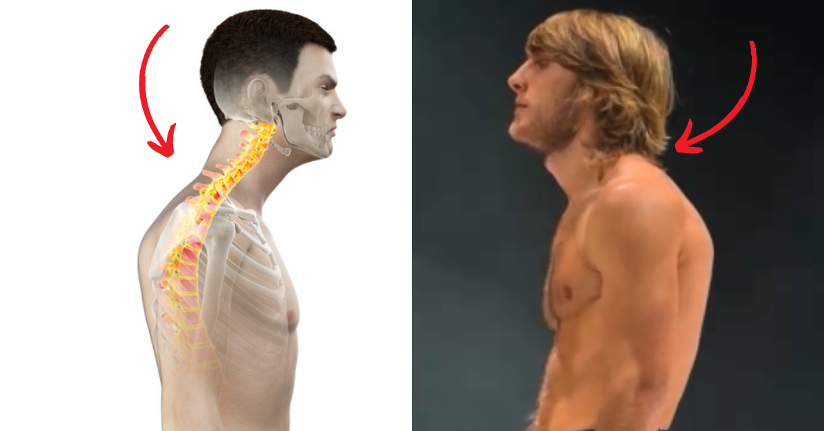 Tech Neck in UFC: How Paddy Pimblett Can Fix His Posture Before Justin Gaethje Fight